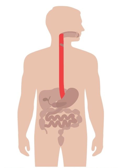 acid reflux and heartburn